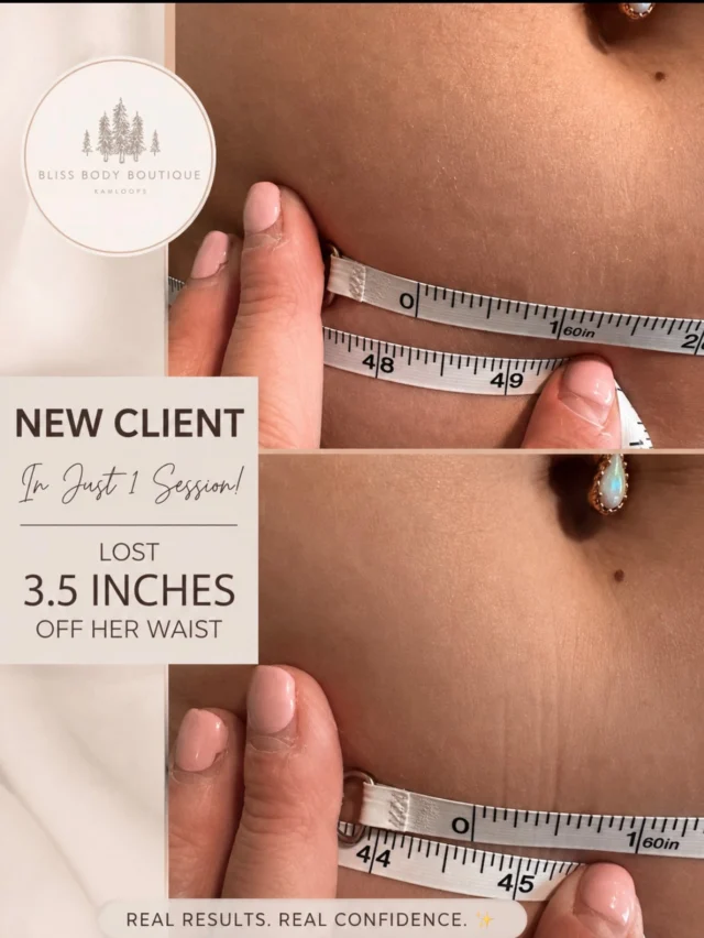 A waist-session results post shared by Bliss Body